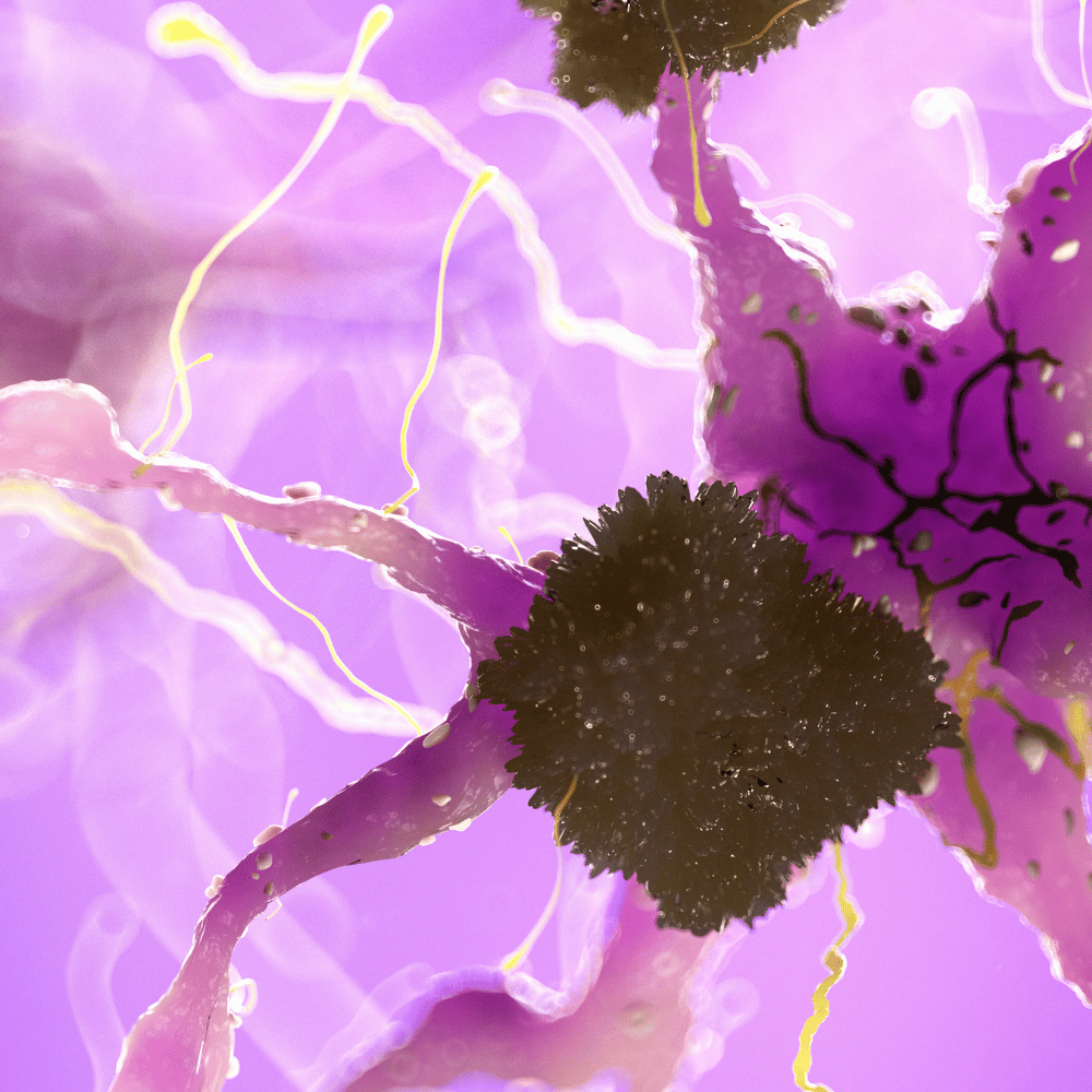 What is Alzheimers Disease