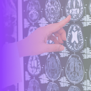 Alzheimer's disease research